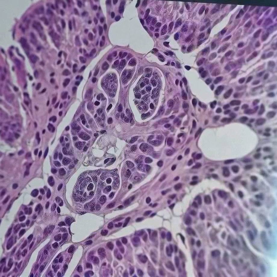 Virtual H&E stained tissue